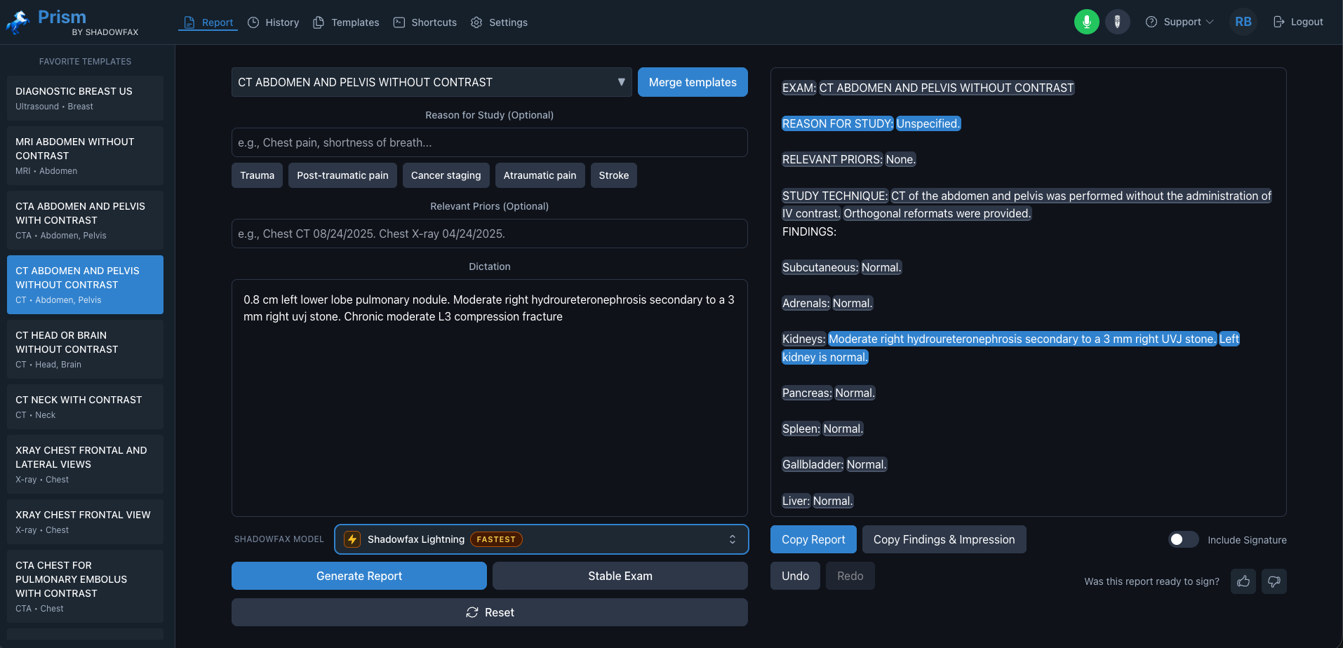 Prism reporting workflow